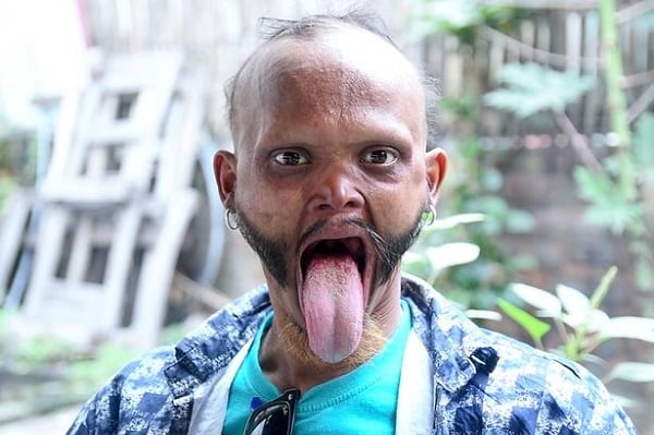 Klaim Lidahnya Terpanjang di Dunia, Pria Ini Bisa Jilat Dahinya