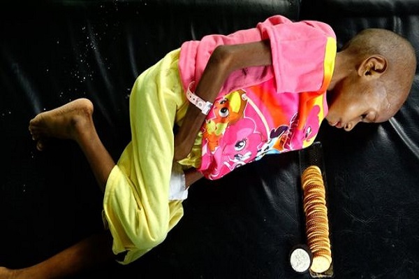 BBC Sebut Anak-anak Papua Kelaparan di Tanah Emas