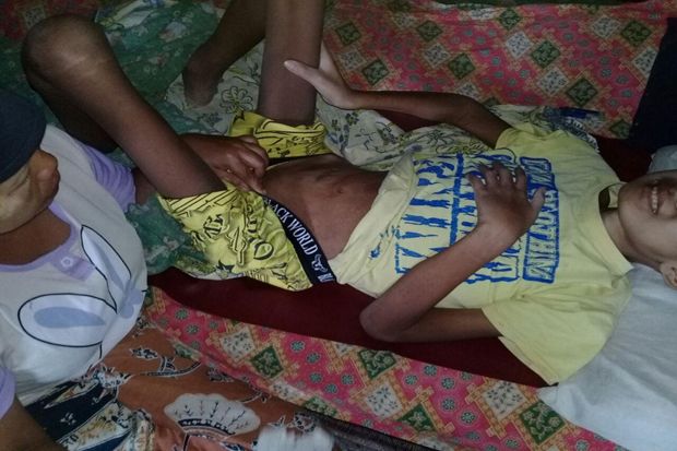 Pascaoperasi Perut, Adam Mengeluarkan Darah dan Nanah