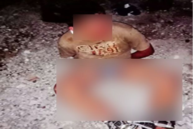 Masuk Rumah Polisi, Anak Autis Babak Belur Dipukuli