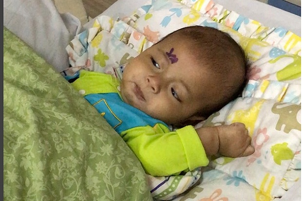 Didiagnosis Katarak, Anak Kedua Asri Welas Sudah Bisa Melihat