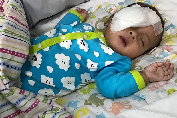 Didiagnosis Katarak, Anak Kedua Asri Welas Sudah Bisa Melihat