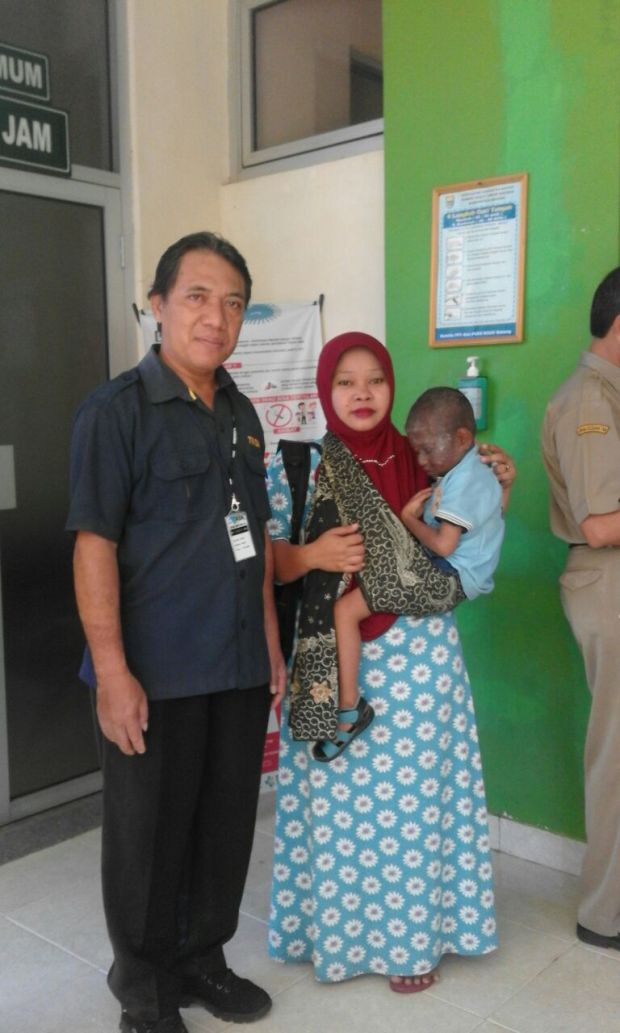 Bupati Batang Perintahkan Balita Penderita Kanker Kulit-Tumor Dirujuk ke RS dr Karyadi