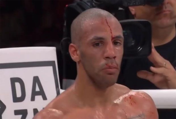 Duel Berdarah, Kal Yafai Pertahankan Juara Terbang Super WBA