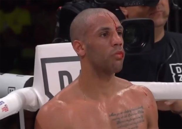 Duel Berdarah, Kal Yafai Pertahankan Juara Terbang Super WBA