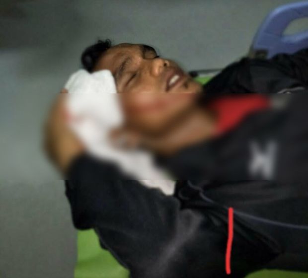 Rombongan Semen Padang Dilempari Batu, Satu Pemain Terluka