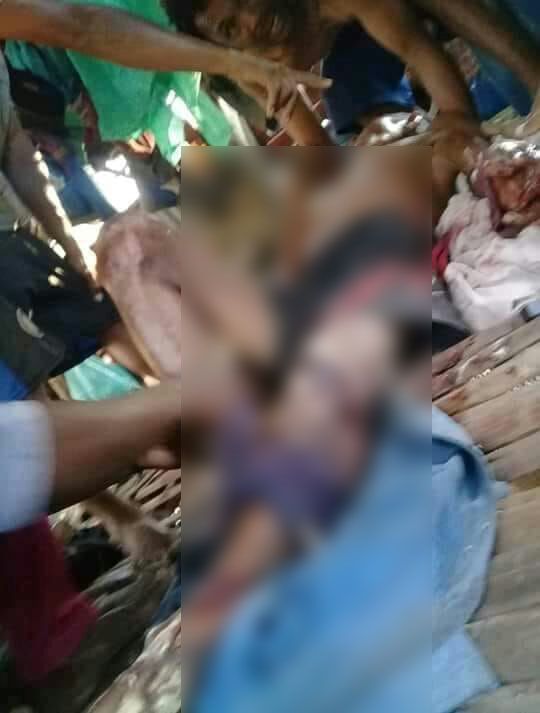 Bertarung Lawan Komodo, Kakek Nahi di Labuan Bajo Terluka Parah