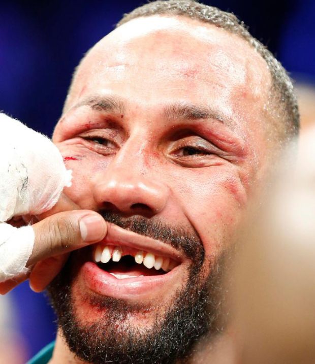 Kesal Gigi Depan Copot, DeGale Tantang Jack Duel Ulang di London