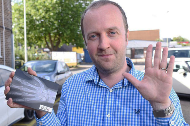 Forgetted The Key, Steve The Cyborg is Coming