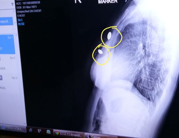Polda Jabar Back Up Polres Sukabumi Usut Penembakan Ibu Atikah