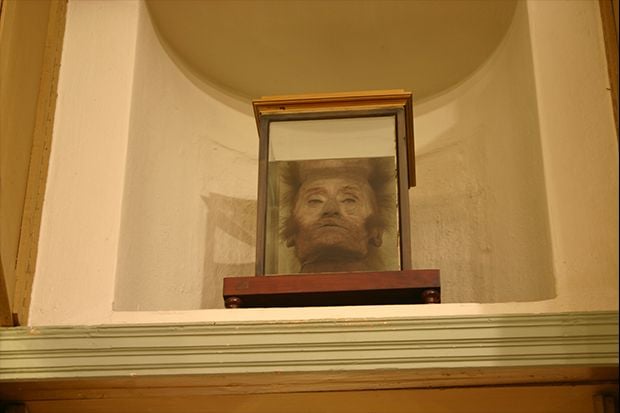 Organ Tubuh Orang Terkenal yang Dipamerkan di Museum