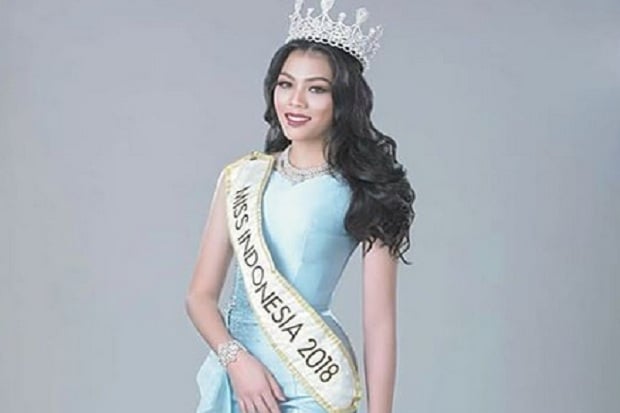 Ini Cara Mendukung Alya Nurshabrina Jadi Miss World 2018