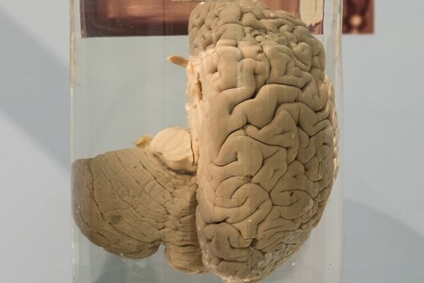 Organ Tubuh Orang Terkenal yang Dipamerkan di Museum