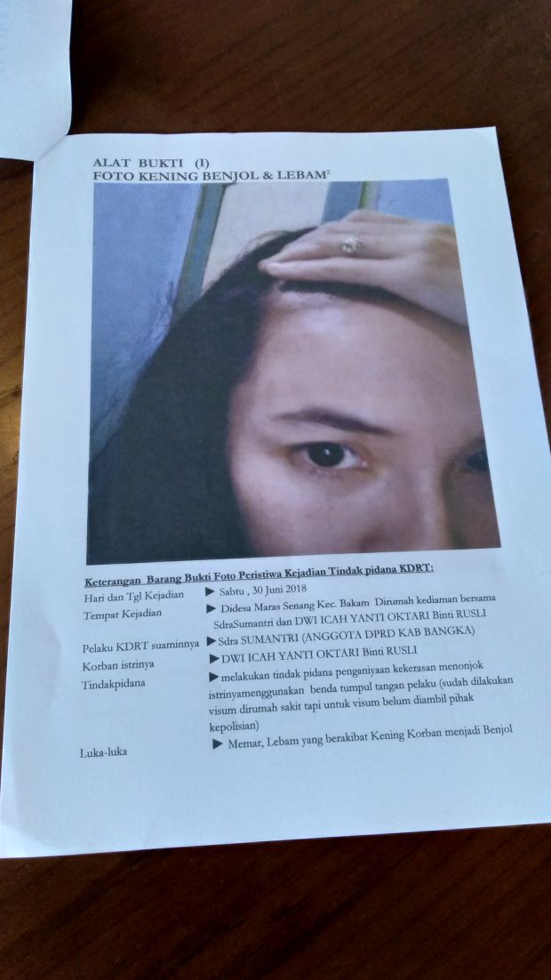 Korban KDRT Anggota DPRD di Bangka, Ingin Bertemu Bayinya