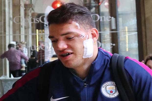 Guardiola Konfirmasi Kondisi Terbaru Ederson