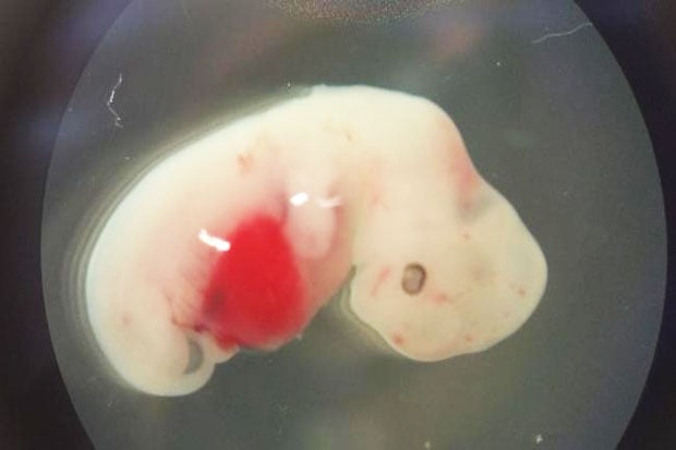 Human Organs Grown in Pigs? Not so Fast!