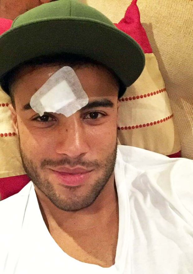 Rafinha Alcantara memamerkan cederanya pasca tubrukan dengan Marc-Andre ter Stegen. (Foto-twitter)