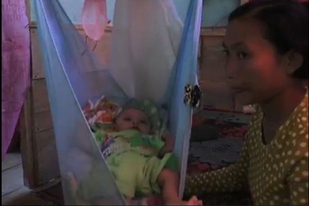 Terkena Virus Rubella, Bayi 5 Bulan Ini Mengalami Kebutaan