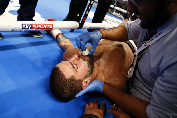 Sam Eggington vs Cerefino Rodriguez