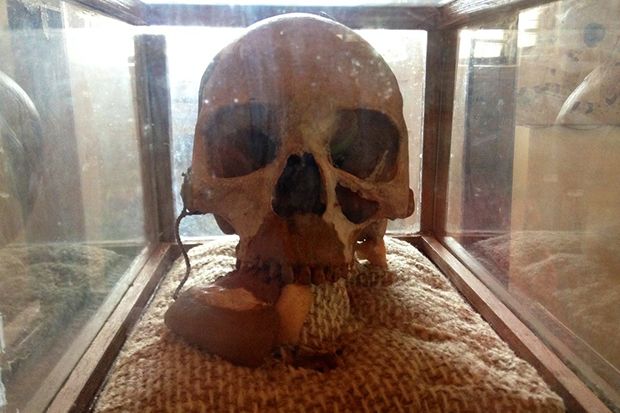 Organ Tubuh Orang Terkenal yang Dipamerkan di Museum