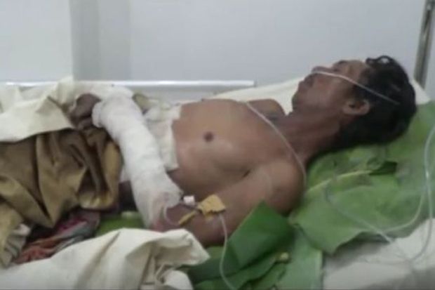 Pasutri Terbakar, Istri Meninggal dan Kondisi Suami Kritis