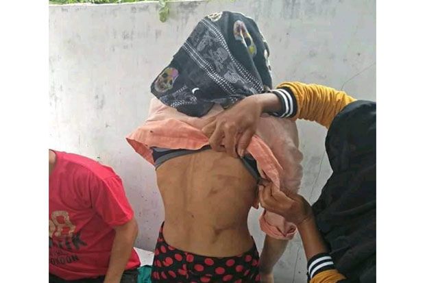 Seorang TKI Asal Bima Disiksa Majikan di Singapura