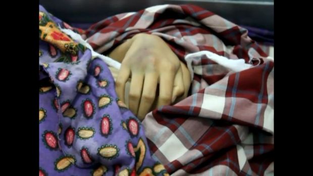 Mahasiswi di Gowa Tewas Kehabisan Darah usai Aborsi