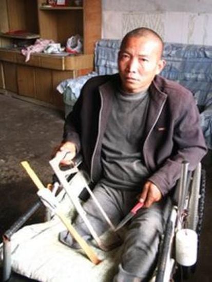 Ini Deretan Nama yang Nekat Operasi Sendiri demi Bertahan Hidup