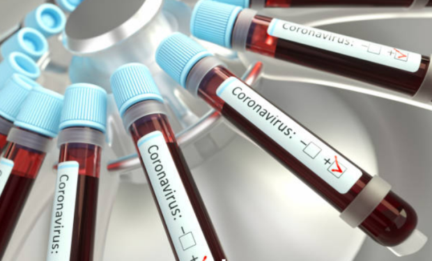 Ini Istilah-istilah yang Sering Muncul Saat Kasus Virus Corona