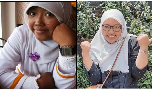 Ditolak Puluhan Kali karena Gemuk, Akhirnya Berhasil Sukses Juga
