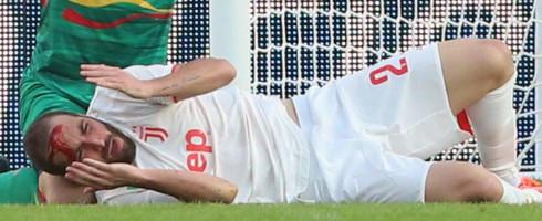 Cedera Serius di Kepala, Higuain Dilarikan ke Rumah Sakit