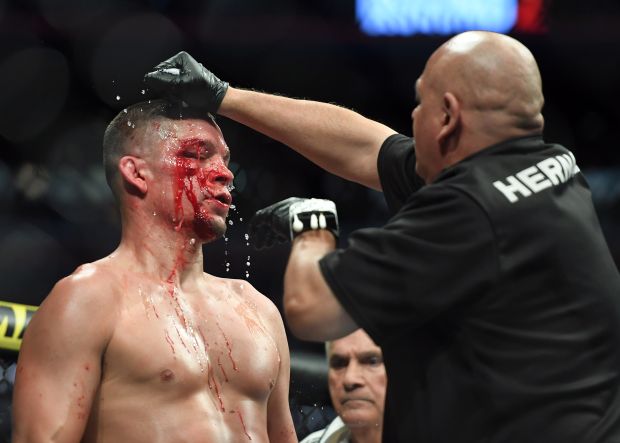 Hasil UFC 244: Bikin Wajah Nate Diaz Berlumuran Darah, Masvidal Rebut Sabuk BMF