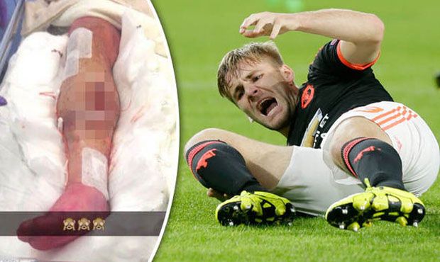 5 Tekel Horor yang Nyaris Menghancurkan Karier Pesepak Bola